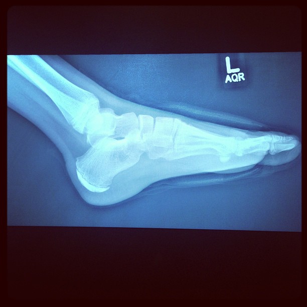 X-ray Emma :)